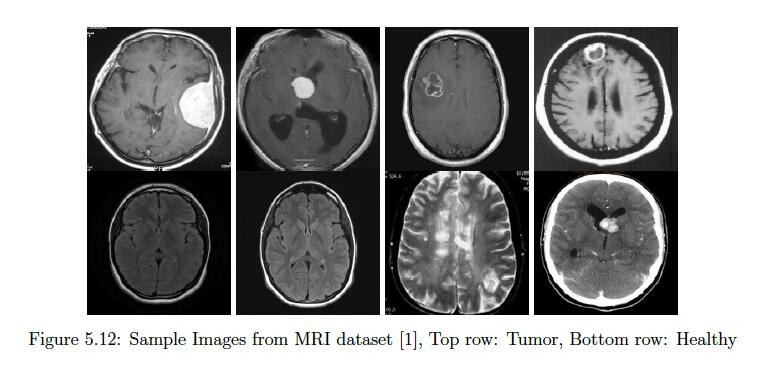 Mri.jpeg